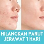 5 Langkah Mudah Untuk Jerawat Hilang dalam 7 Hari! 🤯