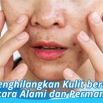 5 Trik Permanen Atasi Kulit Berminyak, Wajah Bebas kilauan 🤩