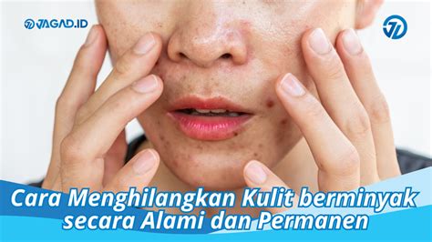 5 Trik Permanen Atasi Kulit Berminyak, Wajah Bebas kilauan 🤩 5 Trik Permanen Atasi Kulit Berminyak, Wajah Bebas kilauan 🤩