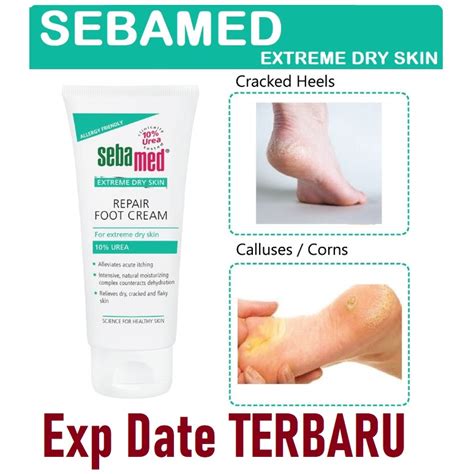 5 Rahasia Sebamed untuk Kulit Kering Glowing Bebas Drama! 5 Rahasia Sebamed untuk Kulit Kering Glowing Bebas Drama!