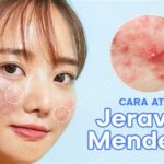 7 Cara Perawatan Wajah di Rumah yang Bisa Menghilangkan Jerawat dan Membuat Kulitmu Bersinar!
