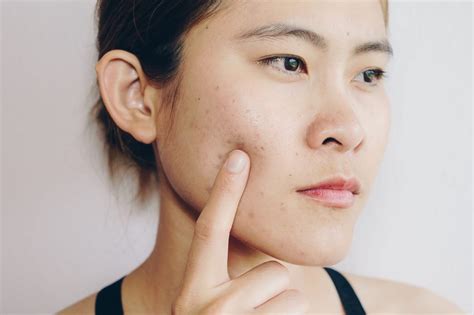 7 Cara Perawatan Wajah di Rumah yang Bisa Menghilangkan Jerawat dan Membuat Kulitmu Bersinar! 7 Cara Perawatan Wajah di Rumah yang Bisa Menghilangkan Jerawat dan Membuat Kulitmu Bersinar!