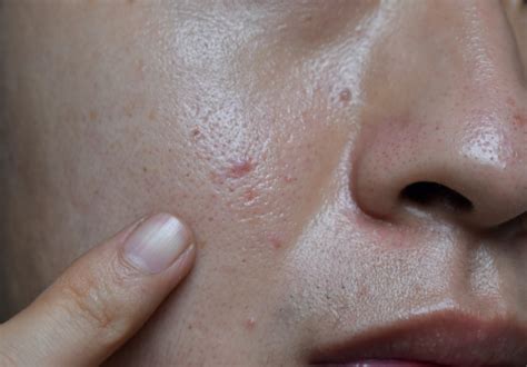 7 Rahasia Perawatan Wajah Remaja Wanita: Bye Wajah Kusam, Halo Glowing Alami! 7 Rahasia Perawatan Wajah Remaja Wanita: Bye Wajah Kusam, Halo Glowing Alami!