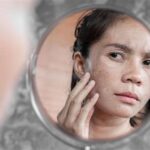 7 Rahasia Poise untuk Kulit Kering: Bye-Bye Kusam, Halo Glowing!